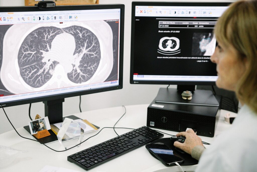 Témoignage de guérison d'un cancer du poumon métastasé